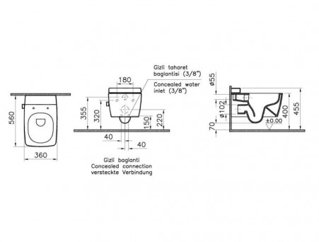 Подвесной Унитаз-Биде «Vitra» Metropole 36x56 Безободковый с Блоком для Чистящей Жидкости и Встроенным Смесителем (7672B003-1687)
